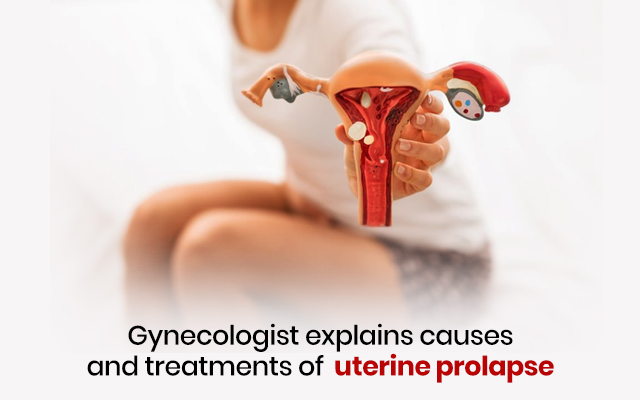 Gynecologist explains causes and treatments of uterine prolapse