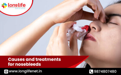 Causes and treatments for nosebleeds